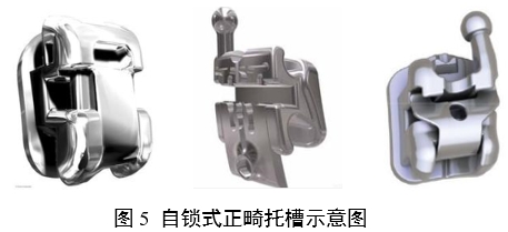正畸托槽注冊(cè)審查指導(dǎo)原則(2022年第41號(hào))(圖5) 正畸托槽注冊(cè)審查指導(dǎo)原則(2022年第41號(hào))(圖5)
