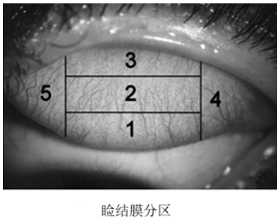 接觸鏡護理產品注冊審查指導原則(2023年修訂版)(2023年第9號)(圖7) 接觸鏡護理產品注冊審查指導原則(2023年修訂版)(2023年第9號)(圖7)