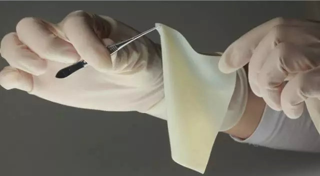 可吸收高分子材料介紹及其在植入醫(yī)療器械中的應用(圖9)